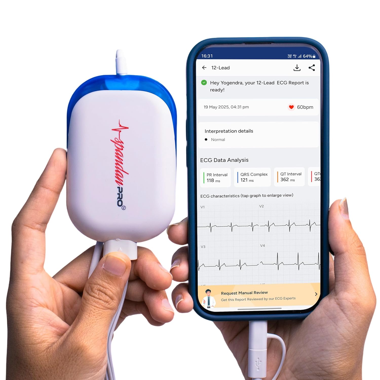 Sunfox Spandan Pro — Portable Medical-Grade 12-Lead ECG for Doctors